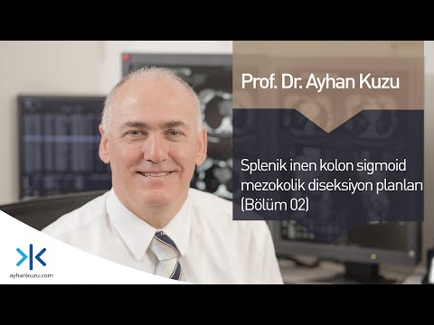 Splenik Fleksura, İnen Kolon Ve Sigmoid Kolon Mezokolik Diseksiyon Planları