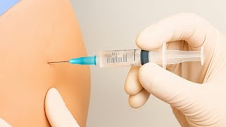 How to Give IM Injection (Intramuscular Injection) Step by Step Guide 7