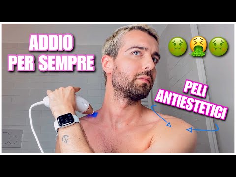 I'LL REVEAL AN EMBARRASSING PROBLEM OF MINE AND LET'S TRY TO SOLVE IT TOGETHER WITH PULSED LIGHT!