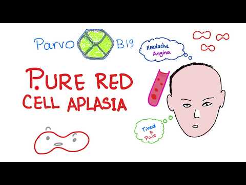 Dolore ai muscoli e le articolazioni della temperatura Catarro in gola e il collo dolore