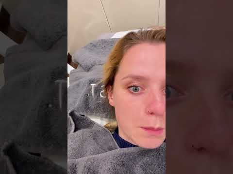 Come With Me To Remove A Skin Lesion