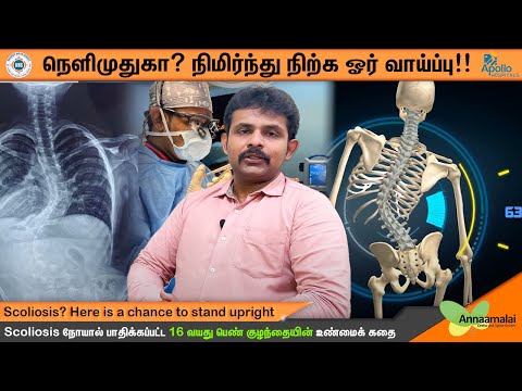 Scoliosis Surgery Success Stories - patient testimonial