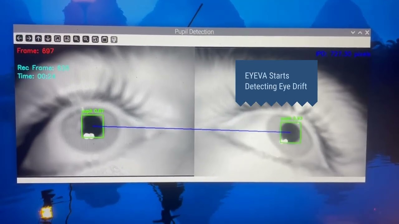 EYEVA™ Demo Video thumbnail — Aaryan Balani demonstrating strabismus detection