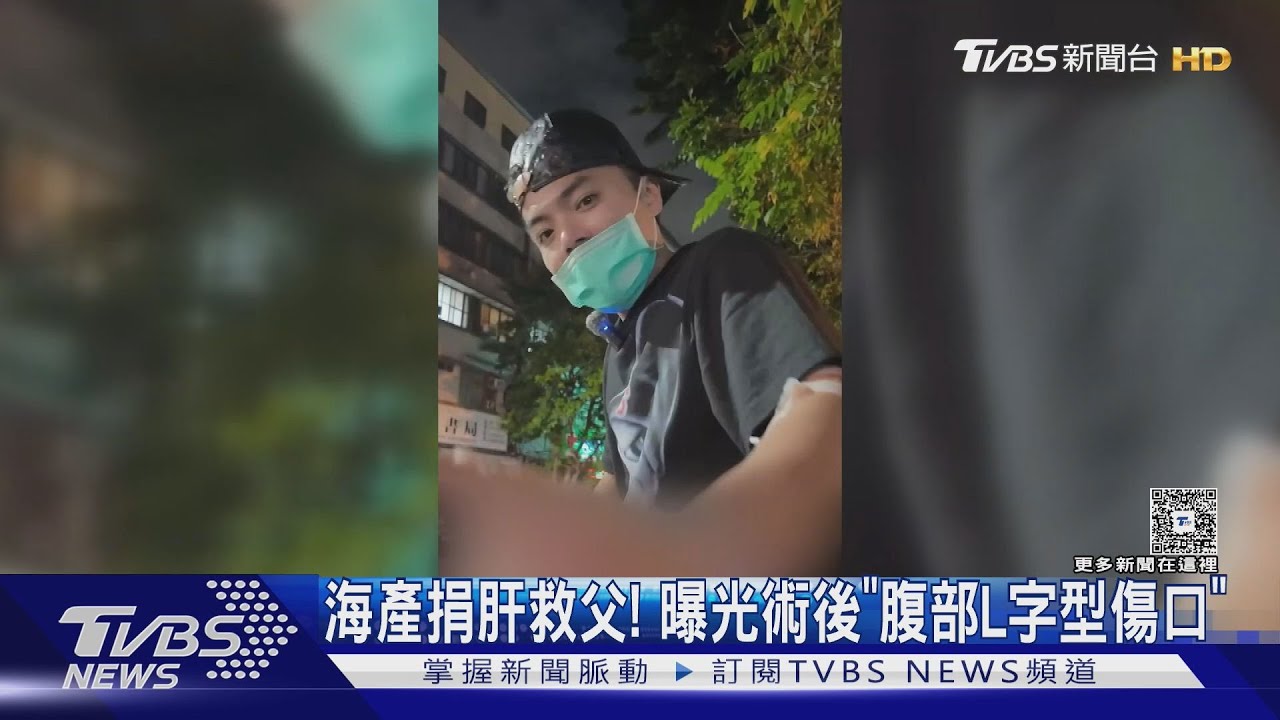海產捐肝救父!曝光術後「腹部L字型傷口」喊:這是光榮的象徵