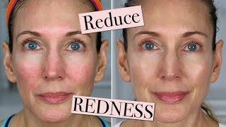 Reduce + Calm Facial Redness! Skincare Tips for Clearer Skin!