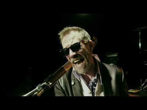 Chris Watson Band (Burn)