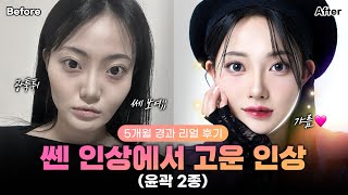 [리얼모델 VLOG] 이제는 포니테일도 자신있게!✨｜윤곽 2종(광대, 턱끝) 5개월 경과 리얼 후기 #일퍼센트성형외과