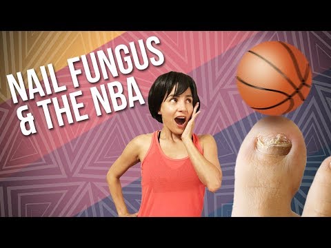 Kung may sakit daliri ng paa sa kuko halamang-singaw RF nail treatment