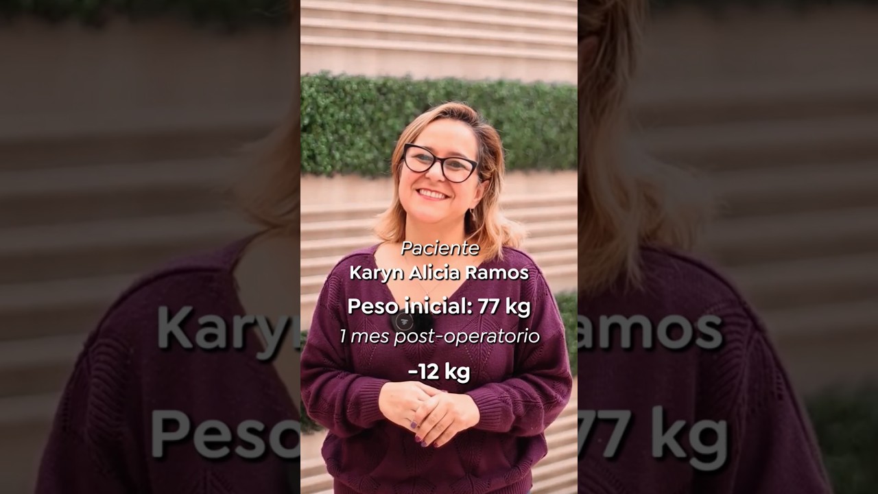 Un mes post-operatorio y así de radiante luce mi paciente Karyn Alicia.