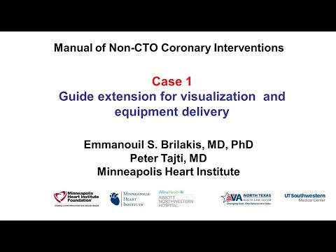 Case 1: PCI Manual - Guide extension for visualization and equipment delivery