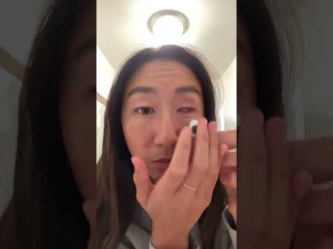 The struggle of having a prosthetic eye… #prostheticeye #eyecancer #cancersurvivor #eyes