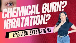 IRRITATIONS VS CHEMICAL BURNS IN EYELASH EXTENSIONS