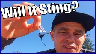 How painful is a Blue Bottle Sting? (Portuguese Man Of War Sting)