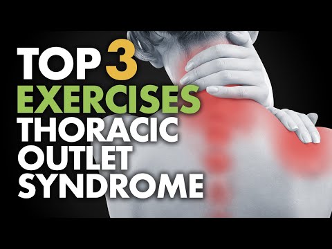 Top 3 Exercises for Thoracic Outlet Syndrome