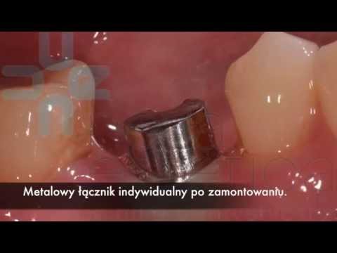 Kulturystyka homeopatia Profesjonalne programy do ćwiczeń siłowych