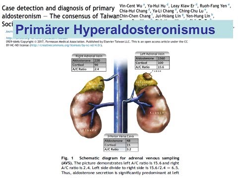 Blutdruck und Alter Cardiopsychoneurosis of hypertensive Aktivität von 10 ICD