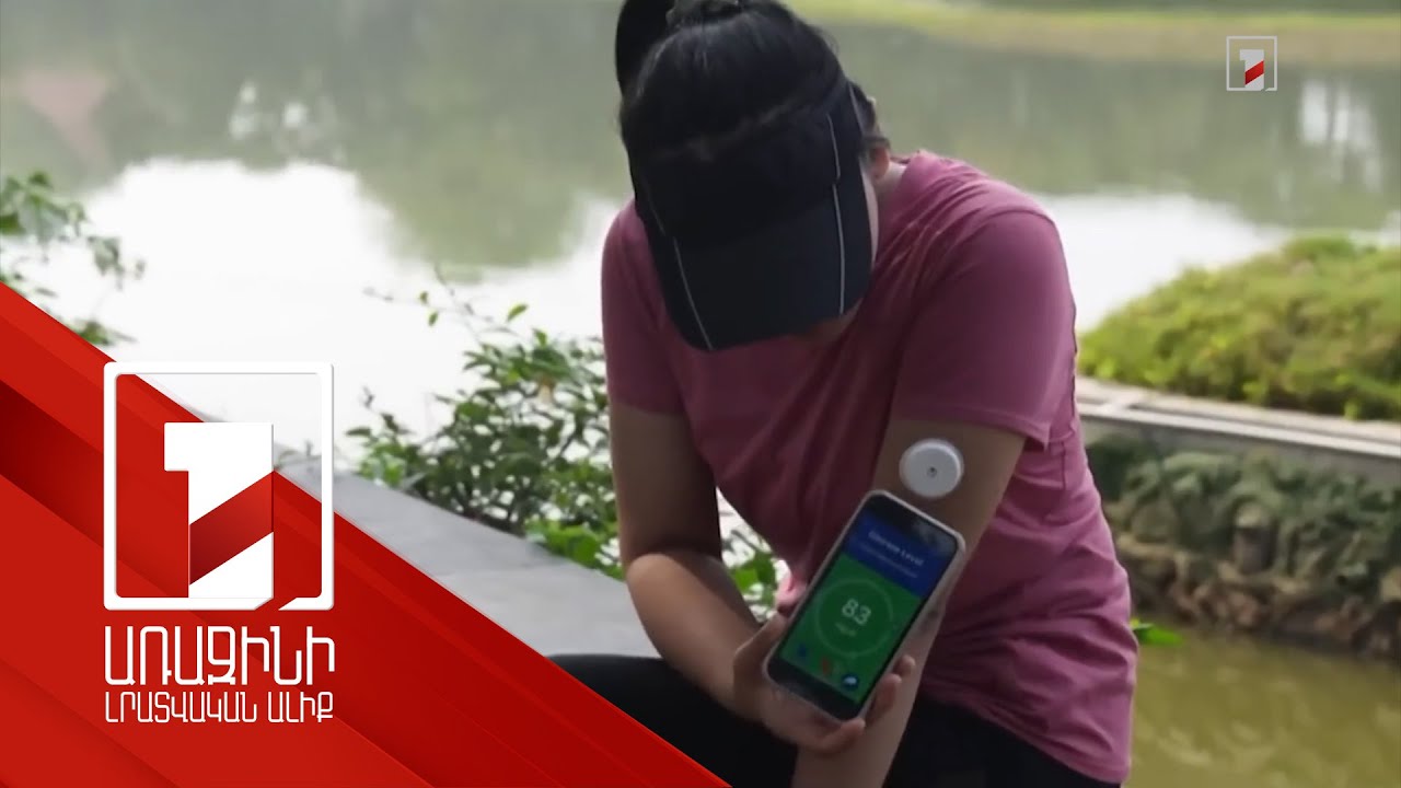 Մինչև տասը տարեկան 244 երեխա անվճար կստանա արյան մեջ գլյուկոզի շարունակական մոնիթորինգի սարք