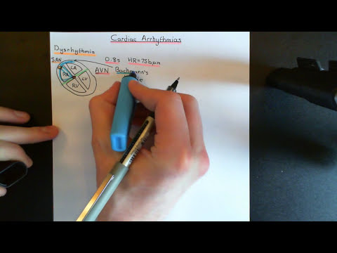 Cardiac Arrhythmias Part 1