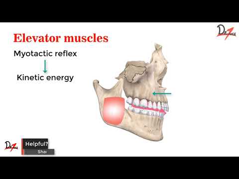 How does activator work? MYOFUNCTIONAL APPLIANCES
