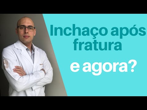 SWELLING AFTER FRACTURE, SURGERY OR CAST - What to do? Is it normal?