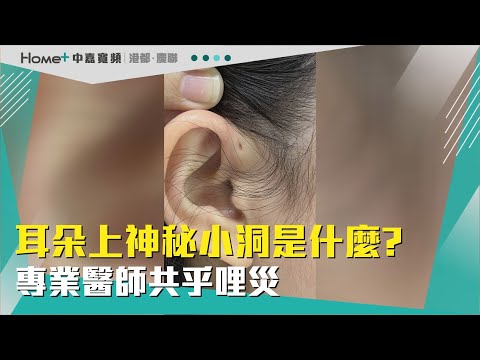 耳朵上面有洞