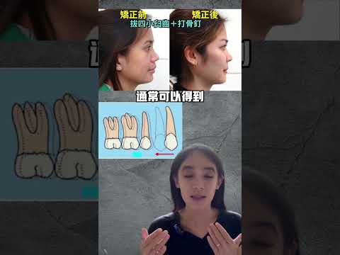 鼻子有骨頭嗎