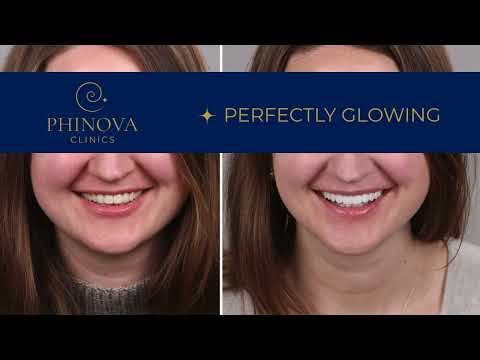 Complete Smile Makeovers and Restorative Dentistry in Izmir, Turkey – Transform Your Smile