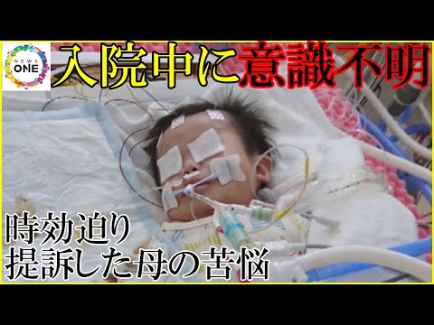 医師が患者の脳の MRI を検査する