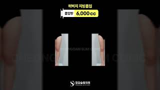 겨울 내내 쌓인 허벅지살, 더워지기 전 정리 완료✅