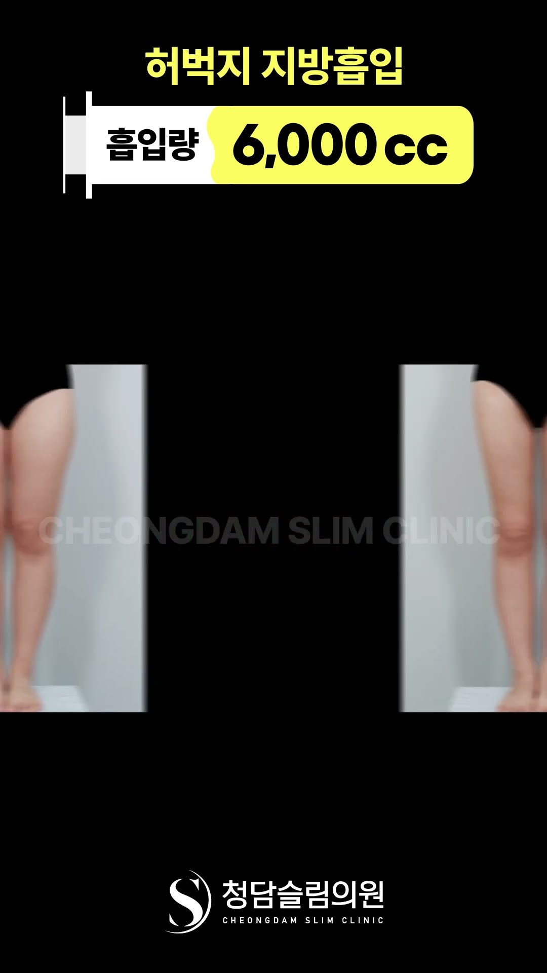 겨울 내내 쌓인 허벅지살, 더워지기 전 정리 완료✅