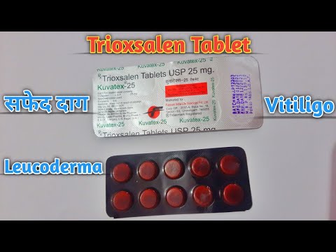 Trioxsalen Tablets IP 5 mg