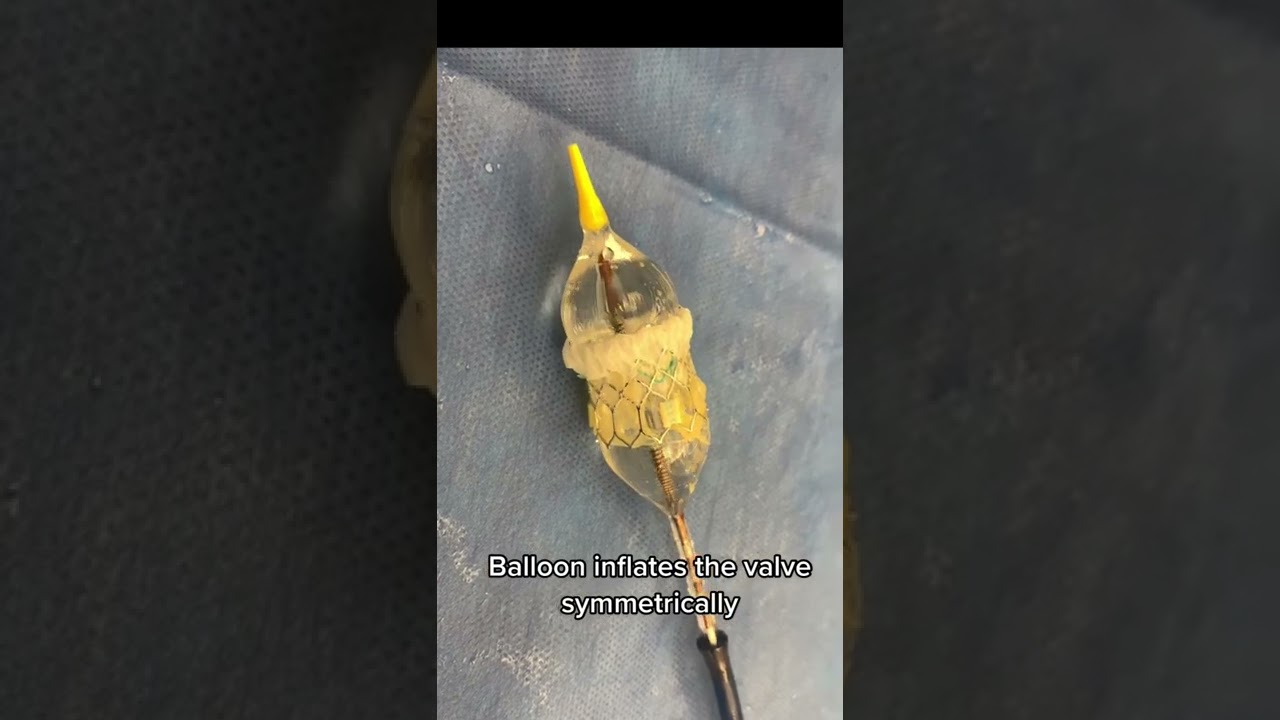 How an Edwards TAVR valve is deployed to treat aortic stenosis  #TAVR #cardiology