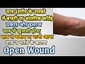 What is a wound, what are its types and treatment? , Open wound in Hindi || MedHealth Support