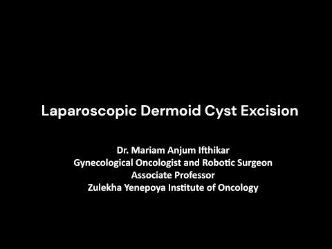 Laparoscopic Dermoid Cyst Excision