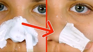 Say Goodbye To Blackheads With A Simple Home Remedy That Works Right Away!