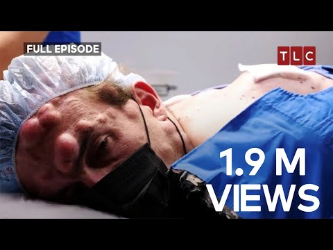 An Illness Even the Doctor Can’t Cure! | Dr. Pimple Popper TLC