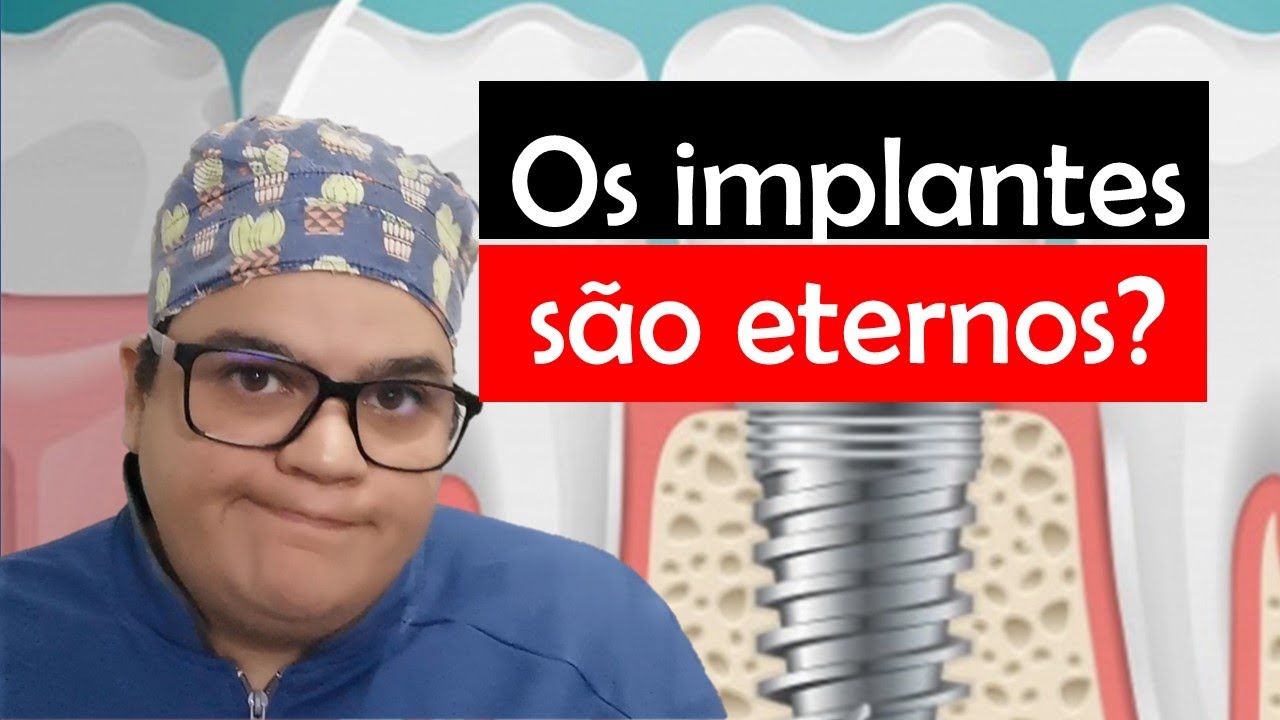 Implantes duram para sempre? |Dra Bianca Rosa