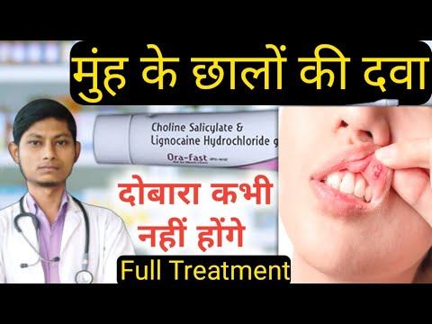 Choline Salicylate & Lignocaine HCl oral gel