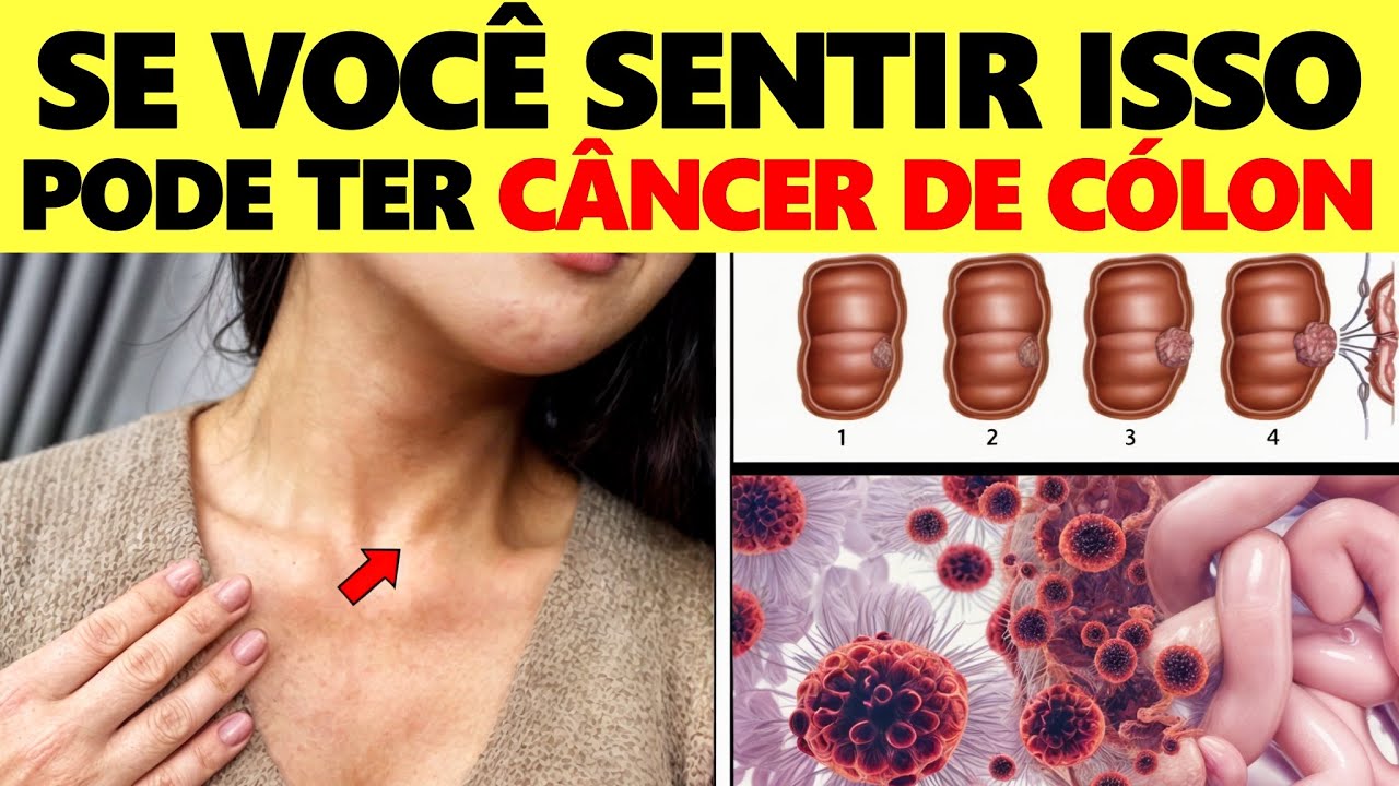 ALERTA! Este Sintoma Estranho Pode Indicar Câncer de Cólon!