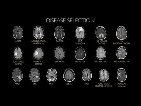 image-Can brain abnormalities be cured?