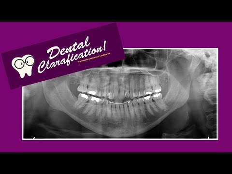 Anatomical Landmarks Found in a Panoramic Radiograph