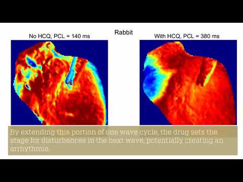Studying Hydroxychloroquine's Harmful Effects on Heart Rhythm