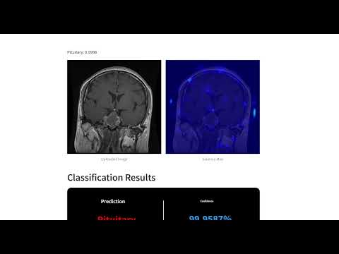 Brain Tumor Classification Walkthrough