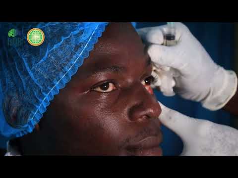 Eye Camps in Burkina Faso
