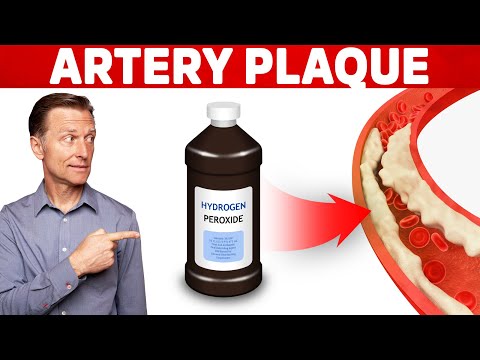 Shingles Natural Relief