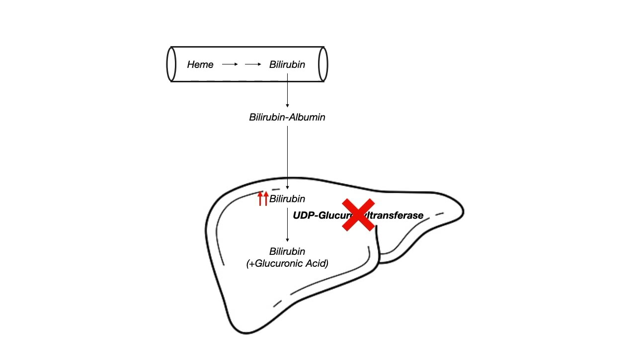 Bilirubin