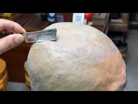 💈ASMR | Remove a lot of dead skin from a man's head and face! 🪒 Old fashioned razor wet shave
