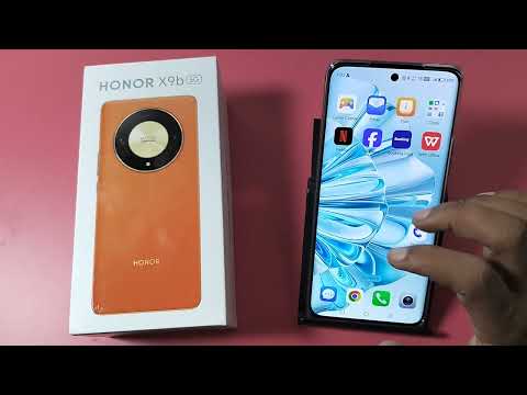 How to set photo on contact number in Honor X9b 5G || Honor me contact mein photo kaise lagaen