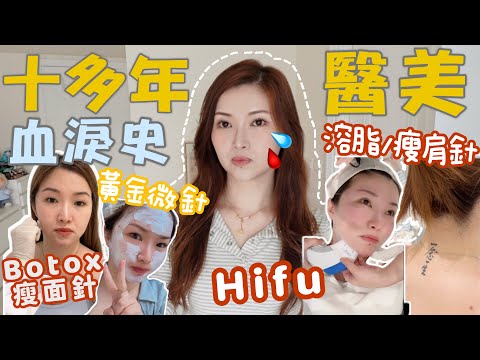 公開10年醫美血淚史🩸縫雙眼皮/眼袋抽脂👀修復被黑店針清造成的凹凸洞😭近年大熱的微針!￼￼光電類高能量Hifu機🔥水光針/BOTOX/溶脂針💉￼家居後續保養✔️Suenn Wong（部份合作）