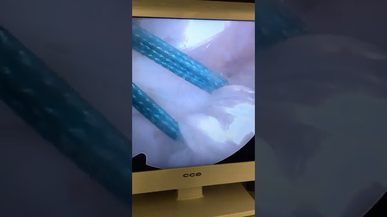 Marcelo Corrêa De Araújo Larrazábal-31